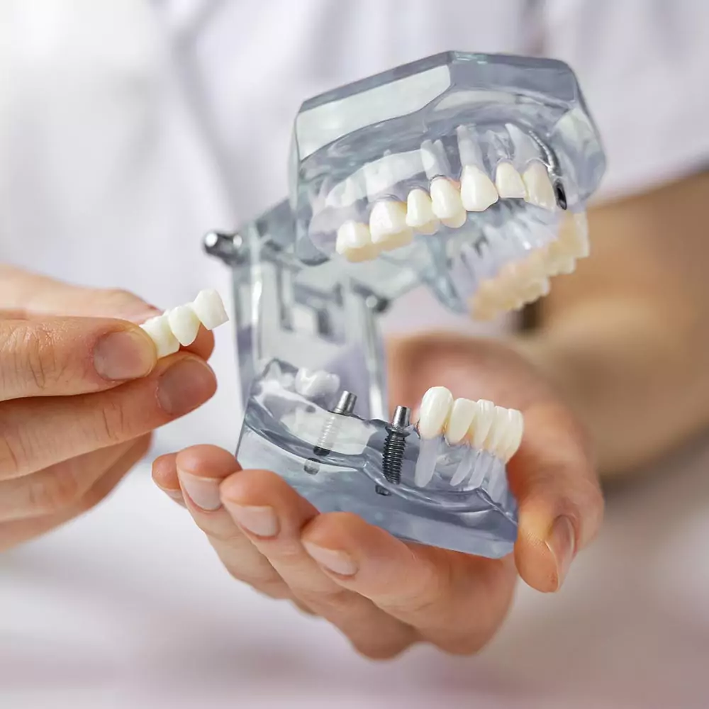 Zahnarzt Bad Neuenahr Ahrweiler Zahnärzte Bad Neuenahr Ahrweiler Implantologie Bad Neuenahr Zahnärzte Bad Neuenahr Ahrweiler Zahnarzt Bad Neuenahr Zahnarzt Ahrweiler