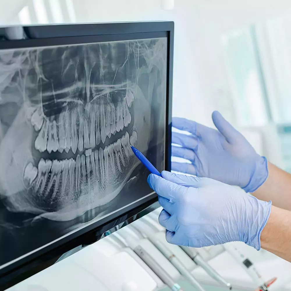 Zahnarzt Bad Neuenahr Ahrweiler Zahnärzte Bad Neuenahr Ahrweiler Endodontie Bad Neuenahr Zahnärzte Bad Neuenahr Ahrweiler Zahnarzt Bad Neuenahr Zahnarzt Ahrweiler
