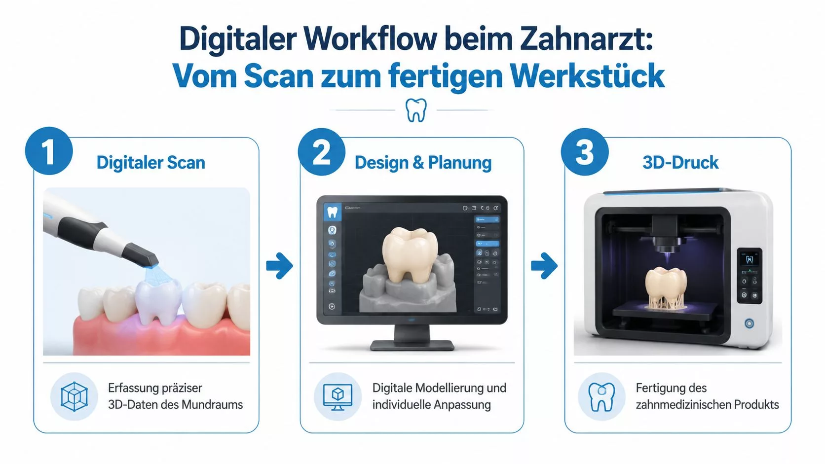 Infografik zum digitalen Workflow beim Zahnarzt von der 3D-Abformung über die Modellplanung bis zum fertigen Zahnersatz.