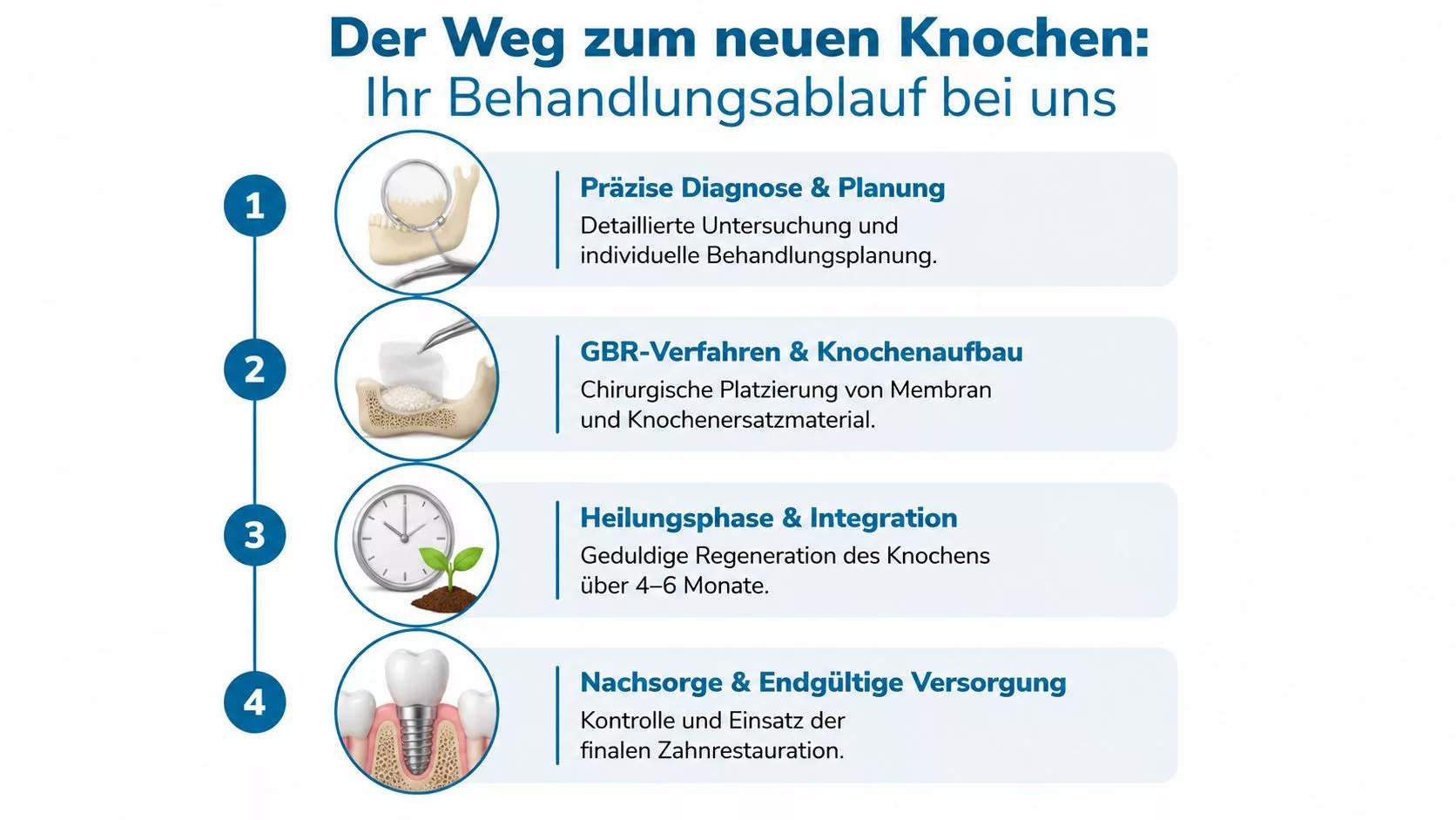 Eine Infografik zeigt den vierstufigen Prozess für einen Knochenaufbau bei einem Zahnimplantat von der Diagnose bis zur Versorgung.