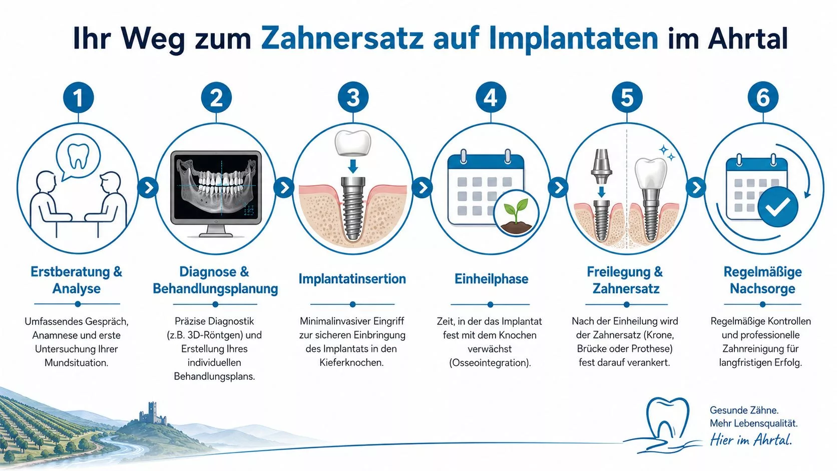 Eine Infografik zeigt den sechsstufigen Weg zu Zahnersatz auf Implantaten, von der Beratung bis zur regelmäßigen Nachsorge.