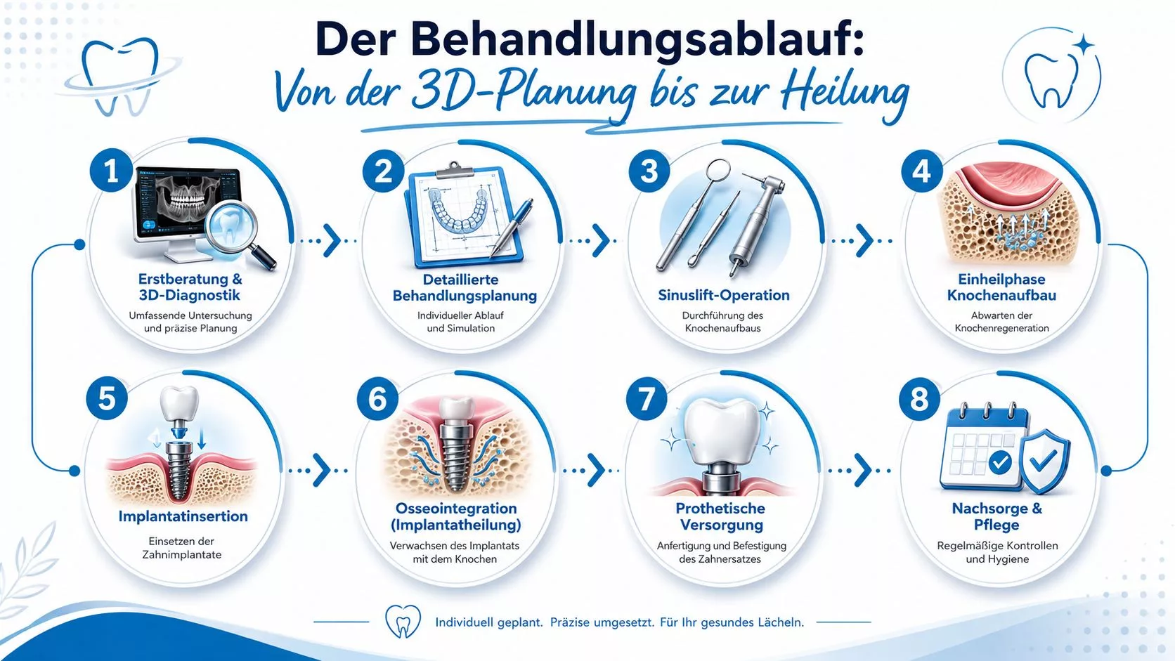 Grafische Darstellung des Behandlungsprozesses für Implantate, von der 3D-Diagnostik bis zur Nachsorge und Zahnpflege.
