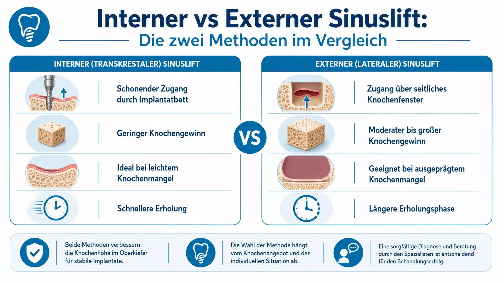 Vergleichsgrafik zwischen internem und externem Sinuslift für den Knochenaufbau bei Zahnimplantaten im Oberkiefer.