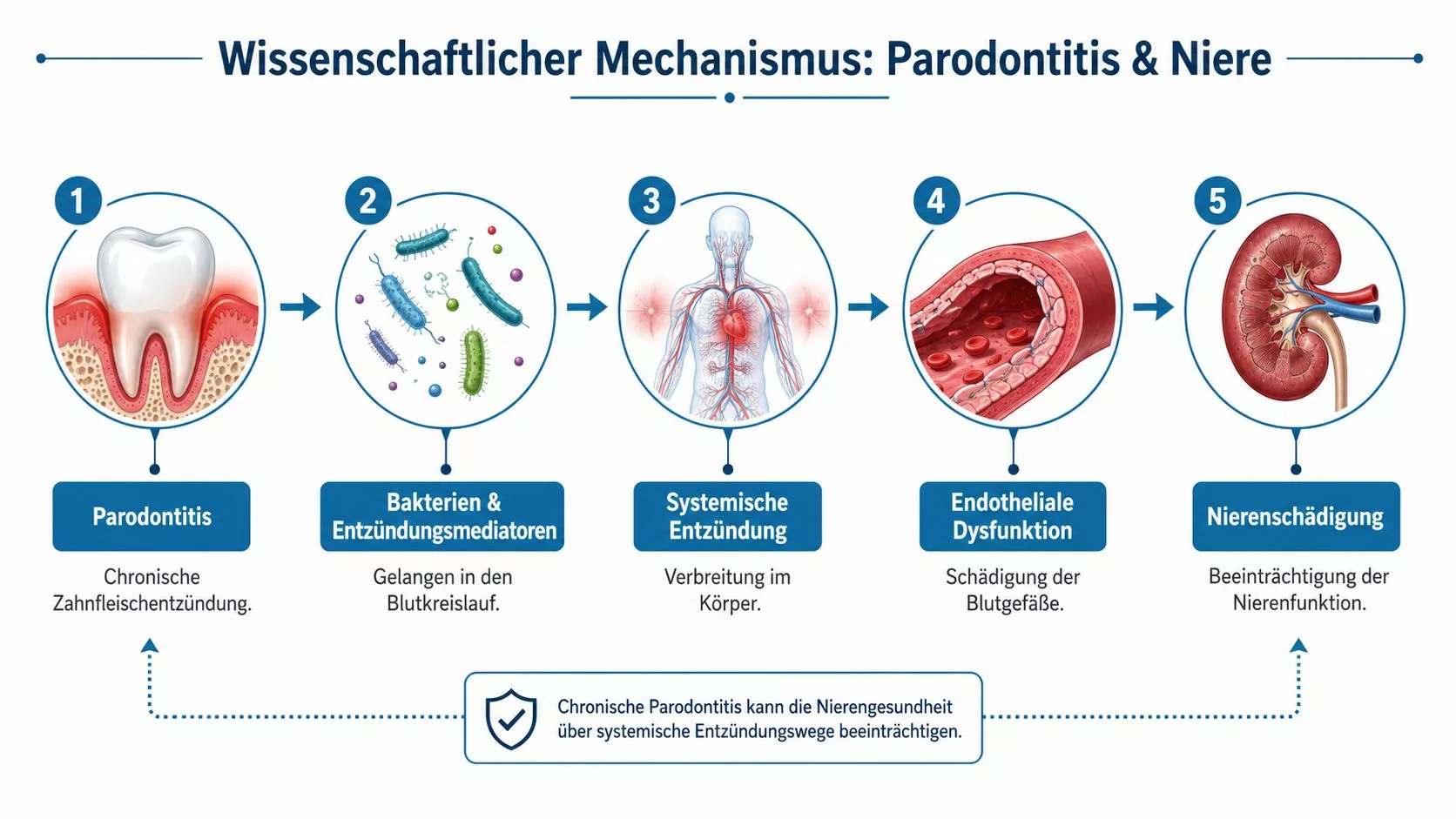 Infografik zeigt den wissenschaftlichen Mechanismus, wie chronische Parodontitis die Nierengesundheit über systemische Entzündungswege negativ beeinflussen kann.