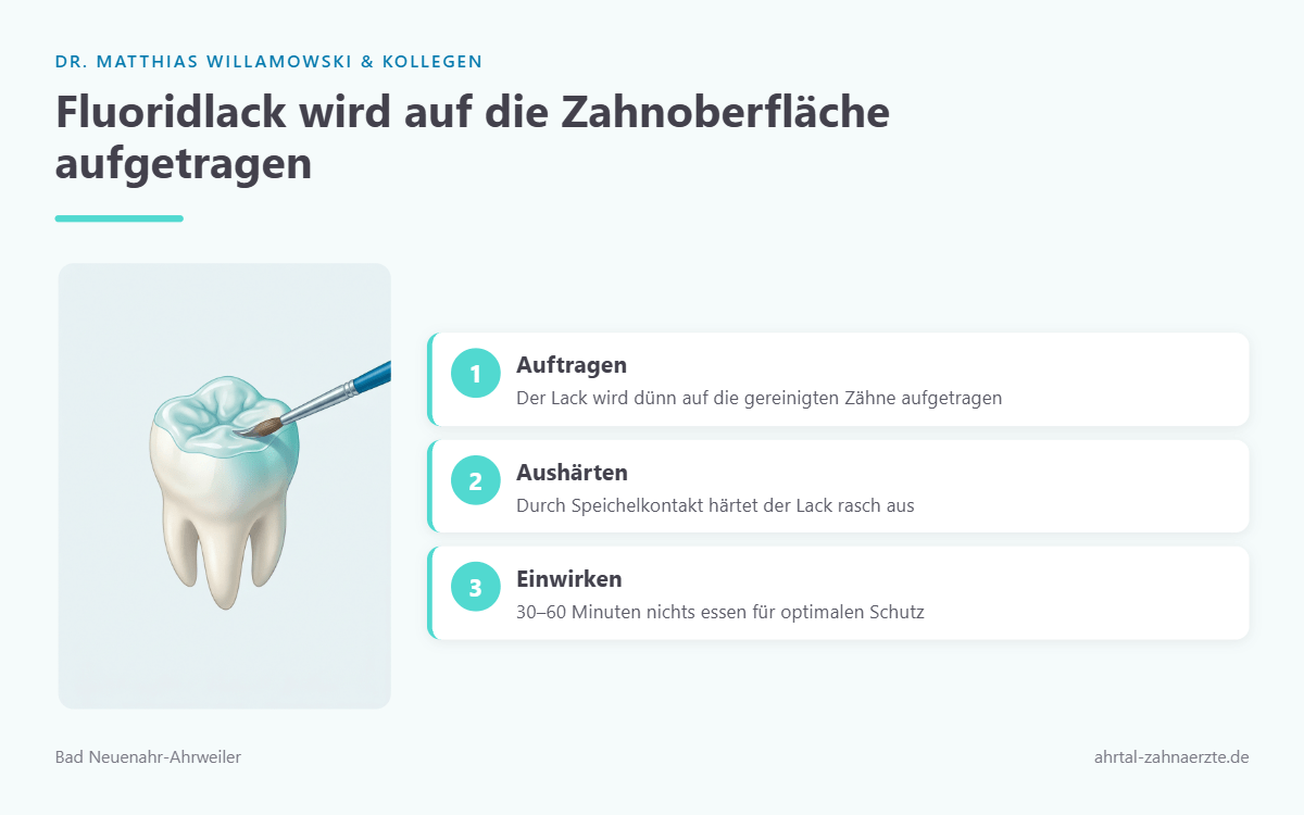 Illustration eines Zahns, auf dessen Oberfläche mit einem kleinen Pinsel eine dünne Fluoridschicht aufgetragen wird