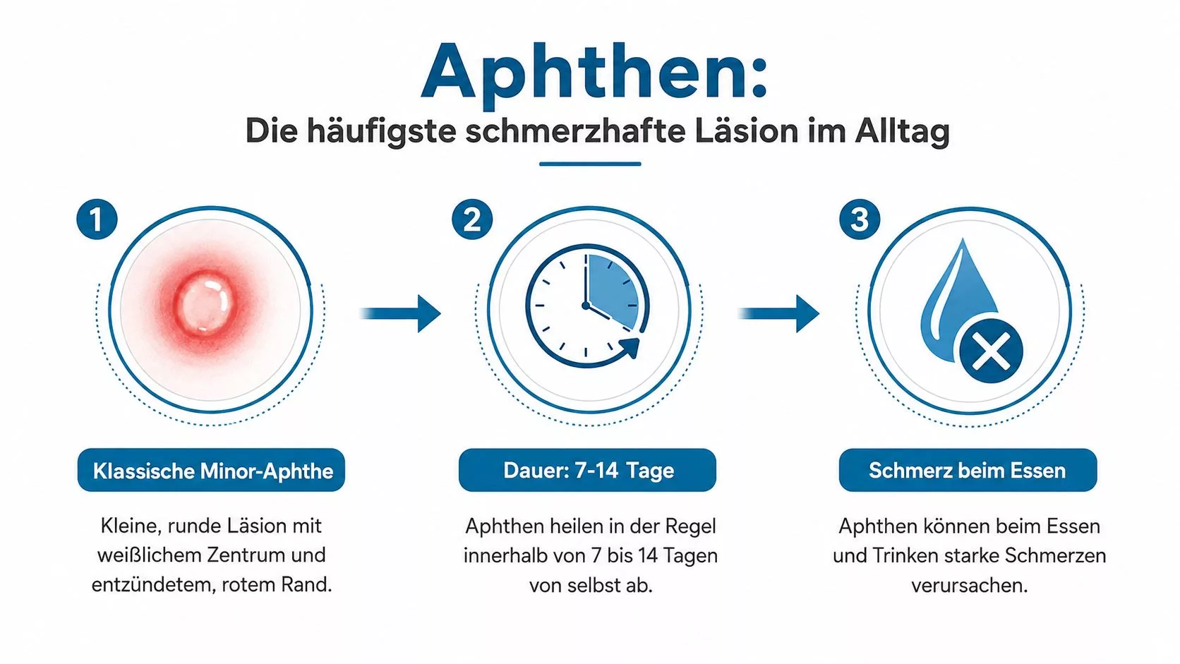 Eine informative Grafik, die das Erscheinungsbild, die Dauer und die Schmerzhaftigkeit von Mundaphthä in drei Schritten erklärt.