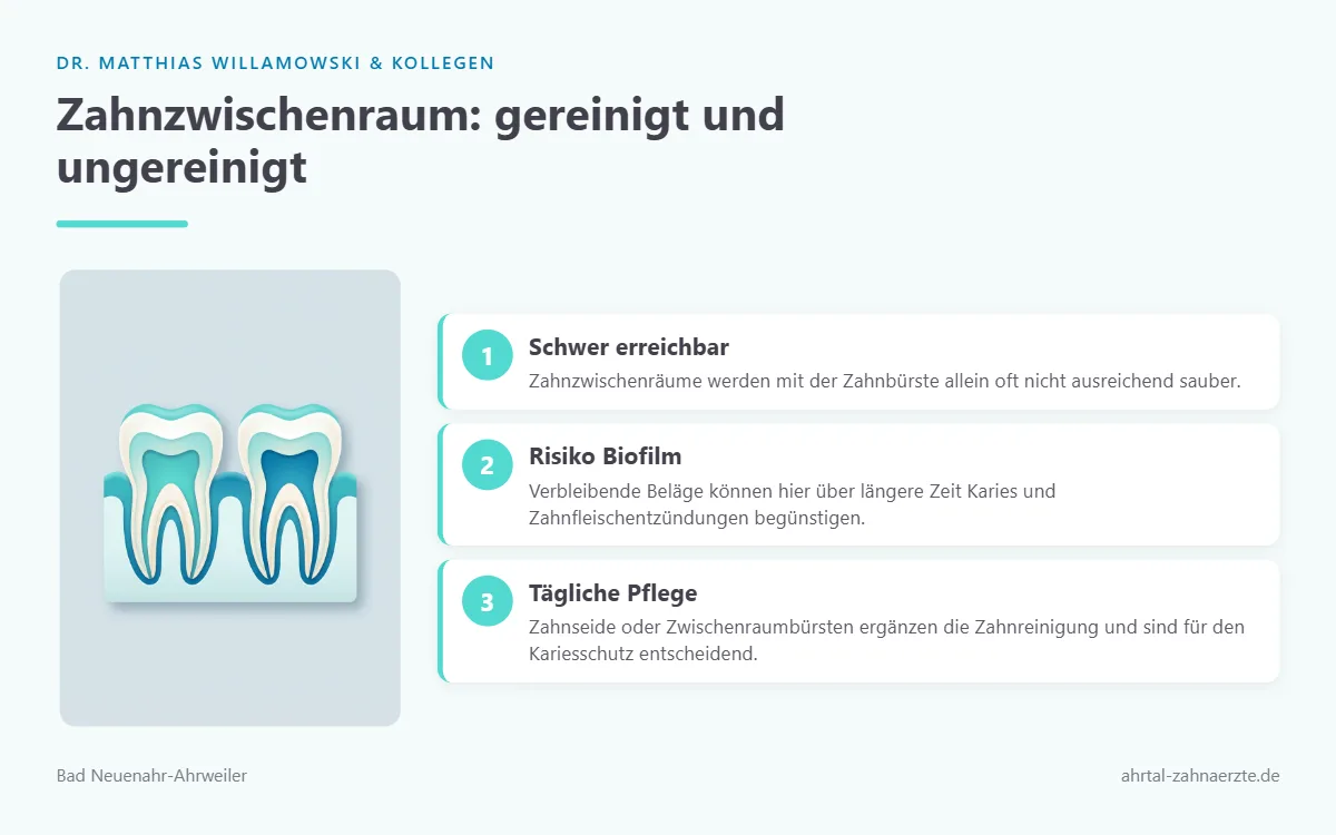 Querschnitt zweier benachbarter Zähne, deren Zwischenraum sichtbar ist – als Motiv für den kritischen Bereich der Belagentfernung.
