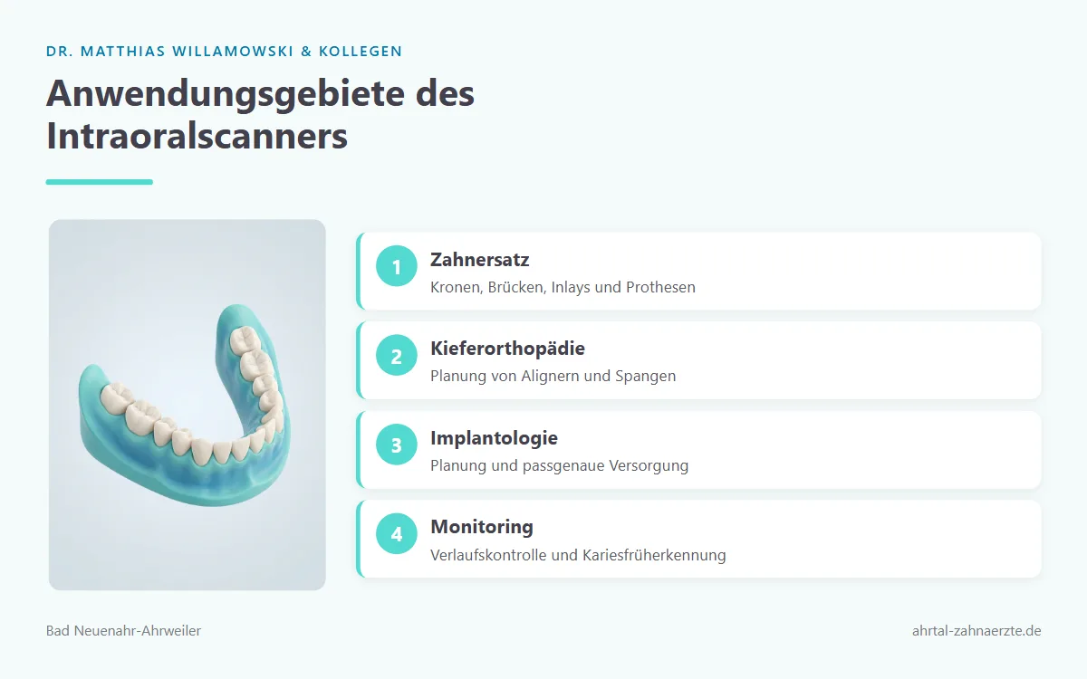 Ein unterer Zahnbogen als dreidimensionales Modell, der die digitale Erfassung der Zahnreihe darstellt.