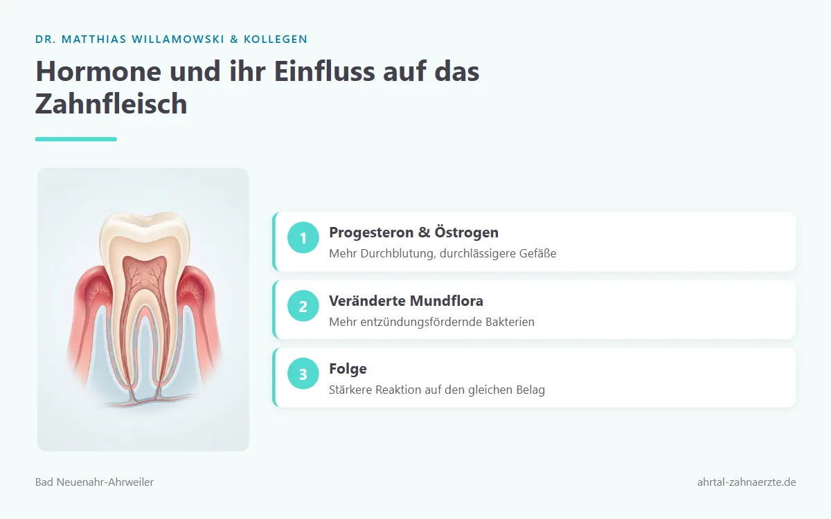 Querschnitt durch Zahn und Zahnhalteapparat mit angedeuteten erweiterten Blutgefäßen im entzündeten Zahnfleischsaum
